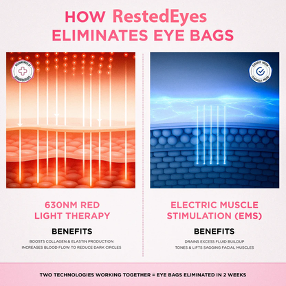 RestedEyes® 2-in-1 Red Light Therapy + Eye Bag Cream