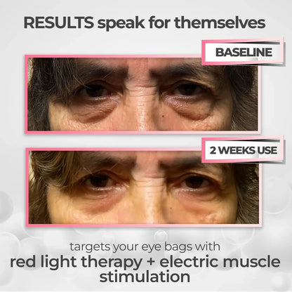 RestedEyes® 2-in-1 Red Light Therapy + Eye Bag Cream